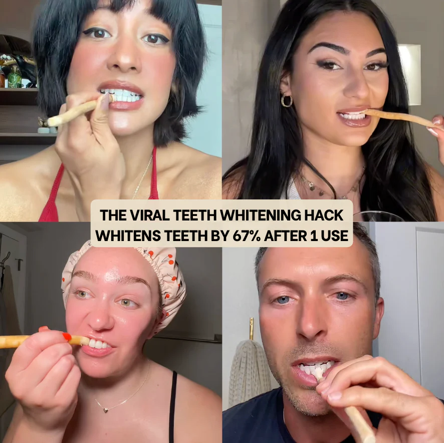 Misora™ Teeth Whitener